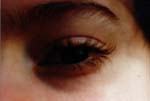 oeil
